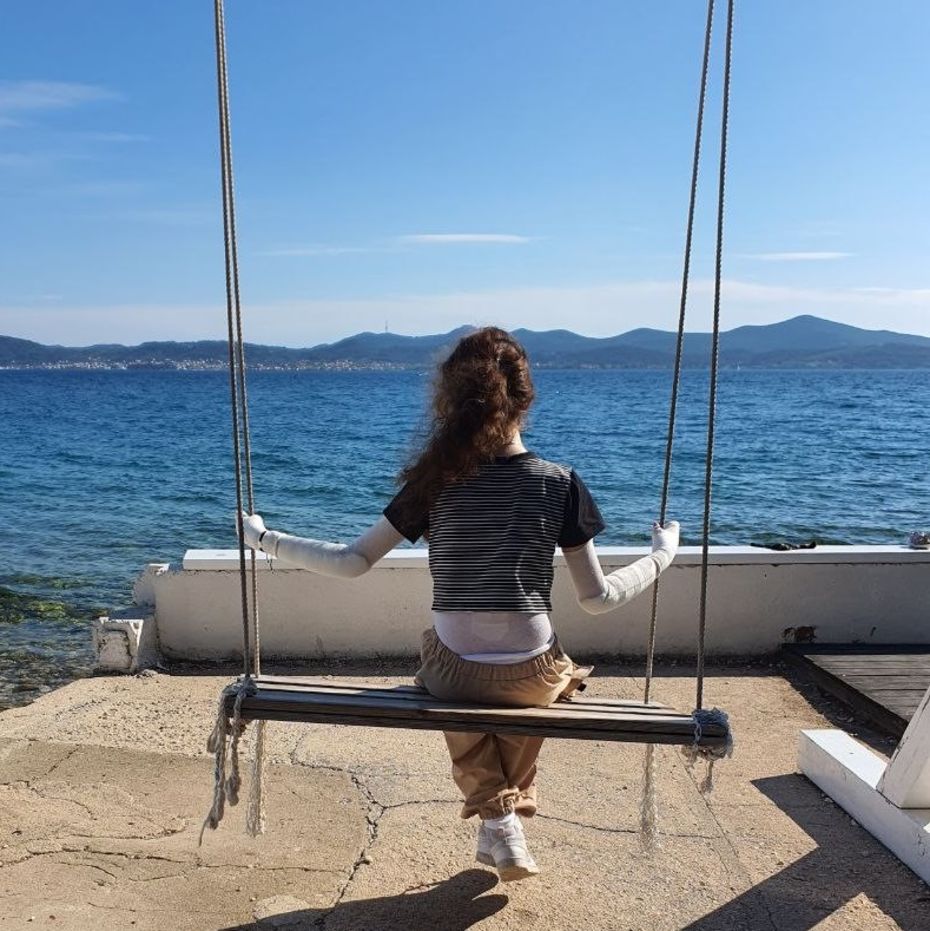 Schmetterlingskind mit Verbänden an den Armen und Beinen sitzt auf einer Schaukel und schaut auf das Meer im Hintergrund