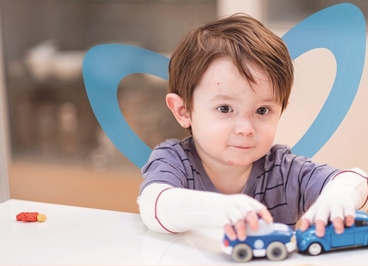 Schmetterlingskind mit Verbänden an den Armenspielt mit blauen Holzautos