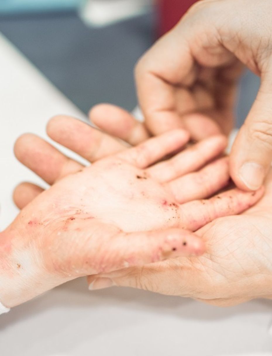 Kinderhand mit Wunden liegt in den Händen