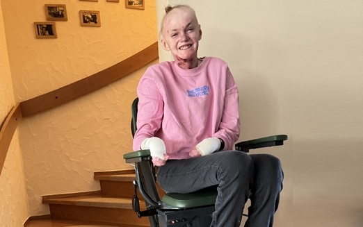 Junge Frau mit EB sitzt auf einem Treppenlift und lächelt