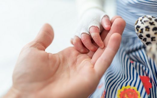 Hand eines Erwachsenen hält die Hand eines Schmetterlingskindes