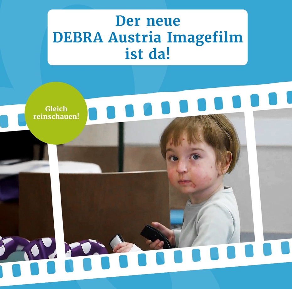 Ausschnitt Imagefilm, Schmetterlingskind schaut in die Kamera